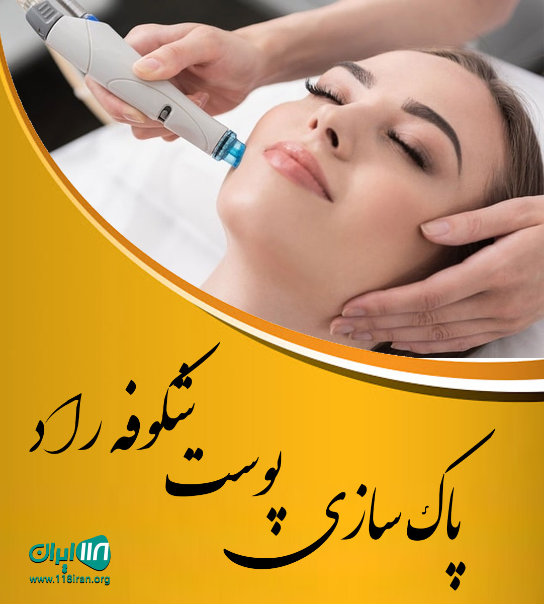 پاک سازی پوست شکوفه راد در کرج پاک سازی پوست شکوفه راد در کرج