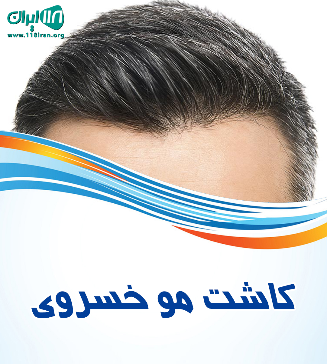 کاشت مو خسروی در اهواز کاشت مو خسروی در اهواز