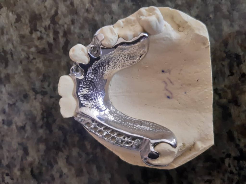 دندانسازی حسن غریبی در اقلید دندانسازی حسن غریبی در اقلید