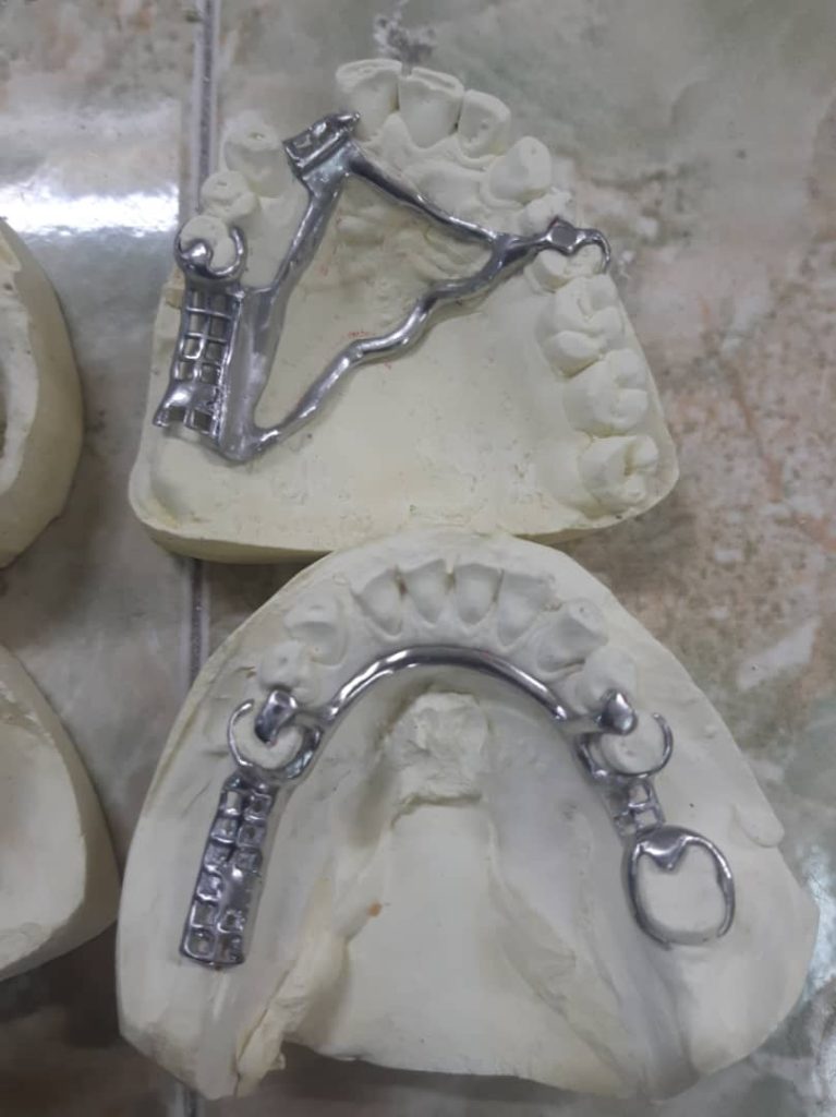 دندانسازی حسن غریبی در اقلید دندانسازی حسن غریبی در اقلید