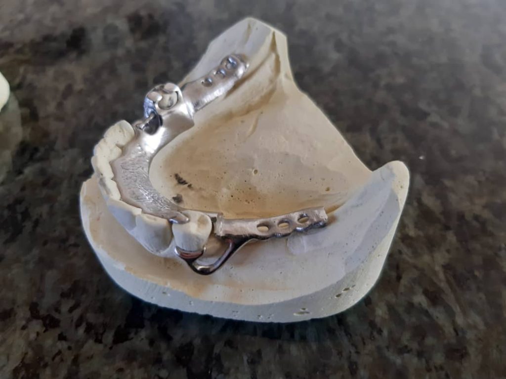 دندانسازی حسن غریبی در اقلید دندانسازی حسن غریبی در اقلید