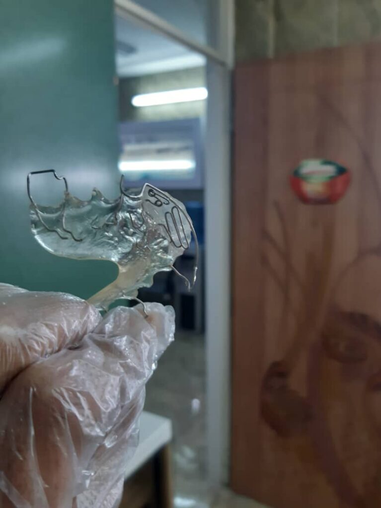 دندانسازی حسن غریبی در اقلید دندانسازی حسن غریبی در اقلید