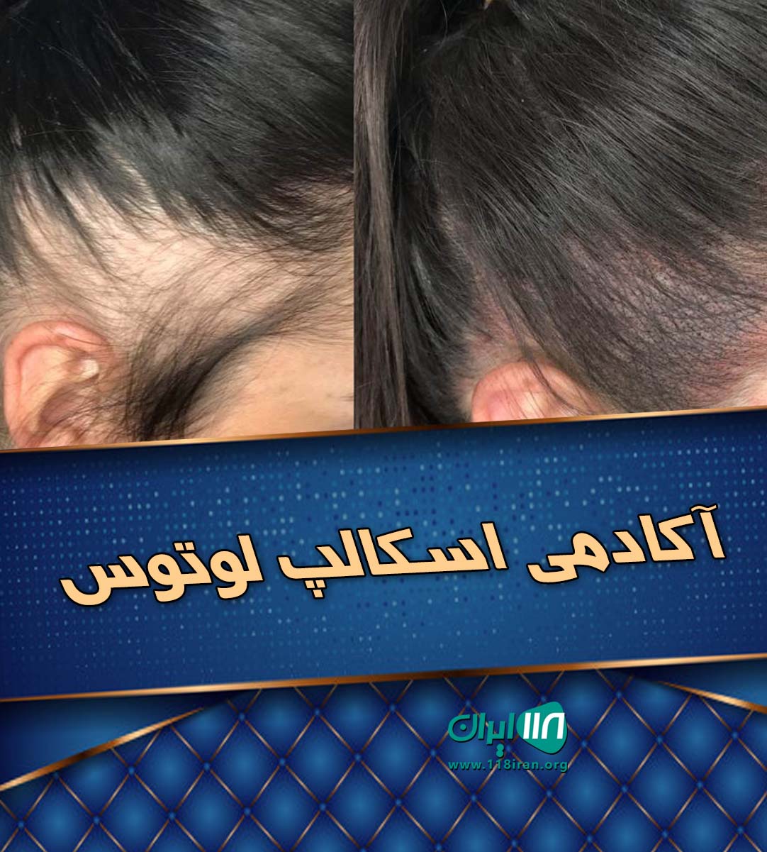 آکادمی اسکالپ لوتوس در اهواز آکادمی اسکالپ لوتوس در اهواز