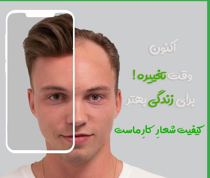 کاشت مو سامره حاجی پور در اهواز کاشت مو سامره حاجی پور در اهواز