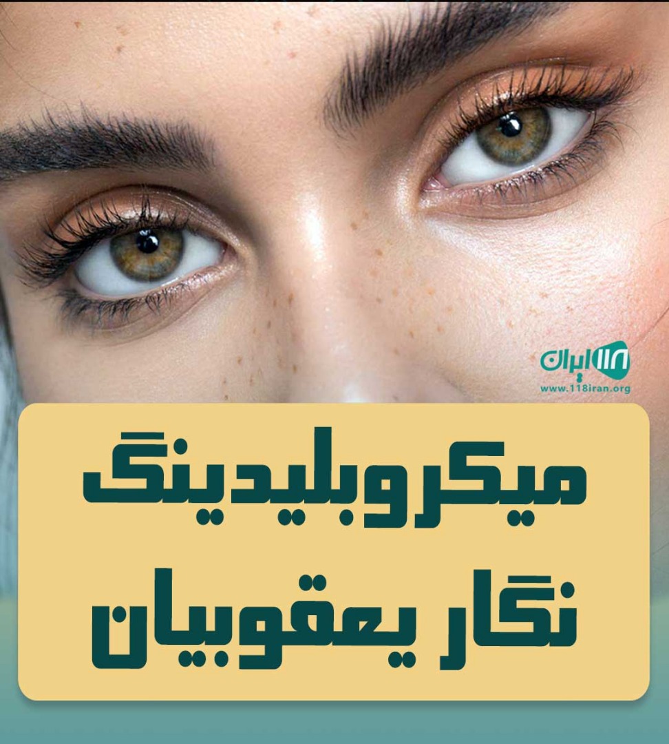 میکروبلیدینگ نگار یعقوبیان در کرج