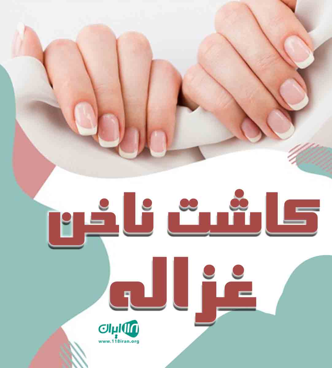 کاشت ناخن غزاله در بندرانزلی کاشت ناخن غزاله در بندرانزلی