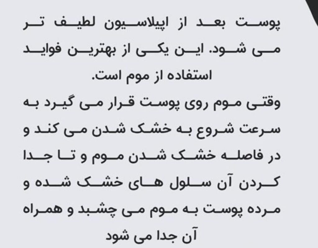 اپیلاسیون رویا در نازی آباد تهران