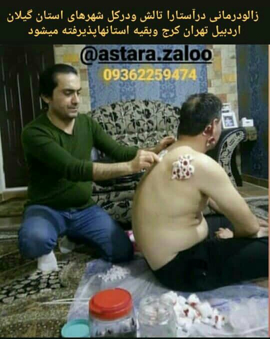 زالو درمانی دکتر دنیادوست در گیلان تهران و کرج