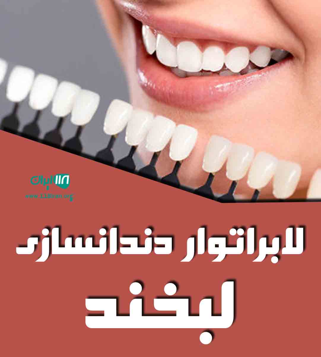 لابراتوار دندانسازی لبخند ساری لابراتوار دندانسازی لبخند ساری