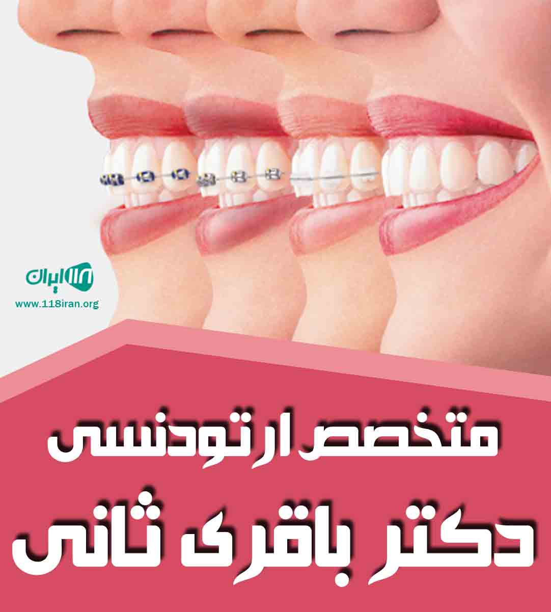 متخصص ارتودنسی دکتر باقری ثانی در مرند