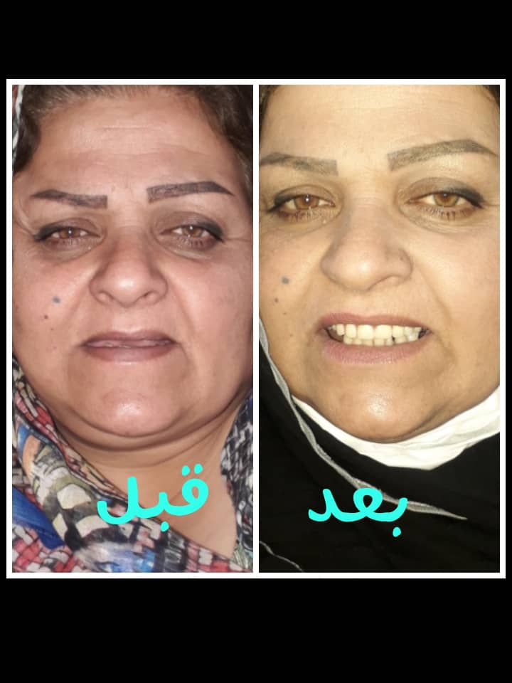 لابراتوار دندانسازی پرشین در گناوه