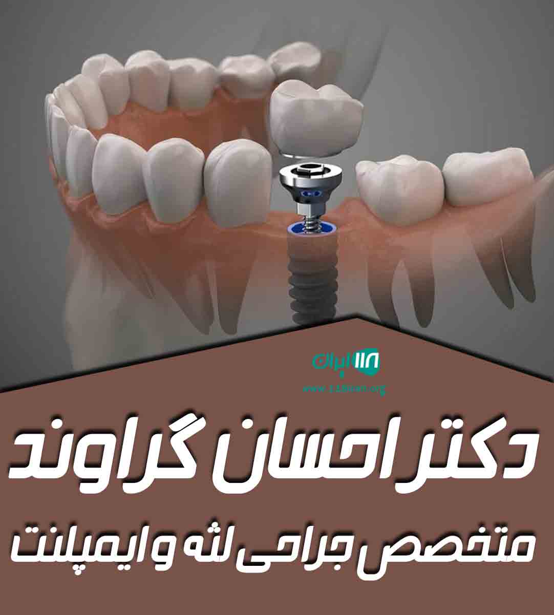 دکتر احسان گراوند متخصص جراحی لثه و ایمپلنت در خرم آباد