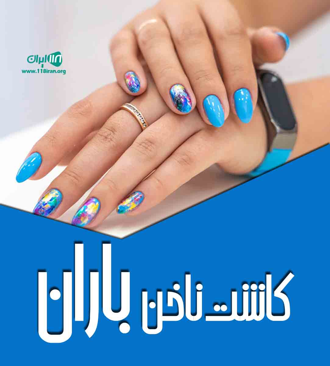 کاشت ناخن باران در مشهد کاشت ناخن باران در مشهد