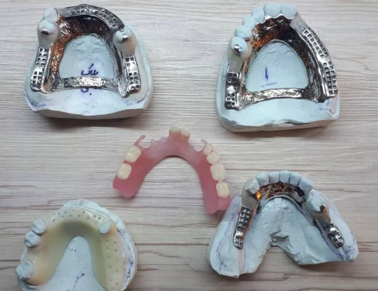 دندانسازی مکاریان در بوشهر دندانسازی مکاریان در بوشهر