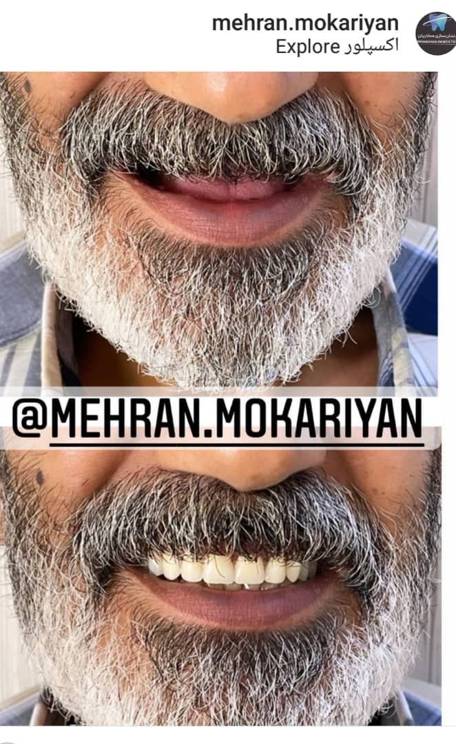 دندانسازی مکاریان در بوشهر دندانسازی مکاریان در بوشهر