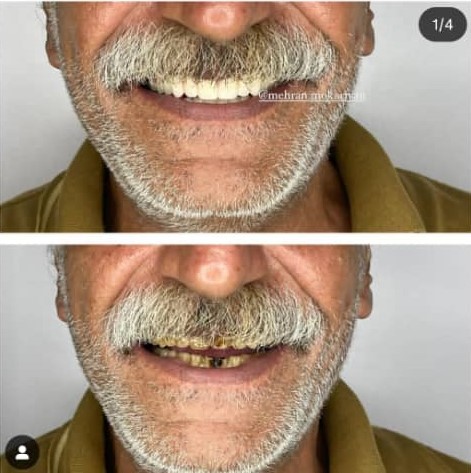 دندانسازی مکاریان در بوشهر دندانسازی مکاریان در بوشهر