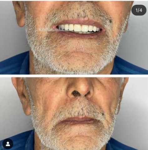 دندانسازی مکاریان در بوشهر دندانسازی مکاریان در بوشهر