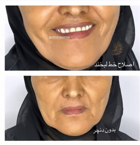 دندانسازی مکاریان در بوشهر دندانسازی مکاریان در بوشهر