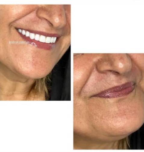 دندانسازی مکاریان در بوشهر دندانسازی مکاریان در بوشهر