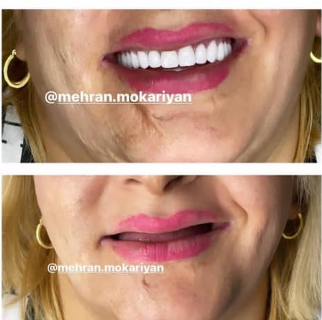 دندانسازی مکاریان در بوشهر دندانسازی مکاریان در بوشهر