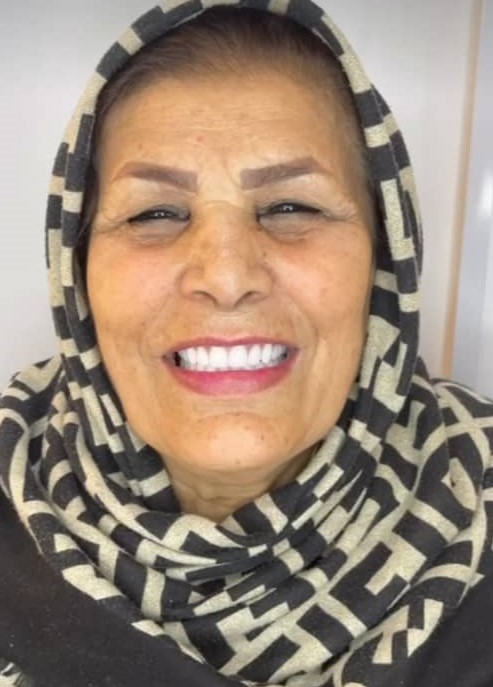 دندانسازی مکاریان در بوشهر دندانسازی مکاریان در بوشهر