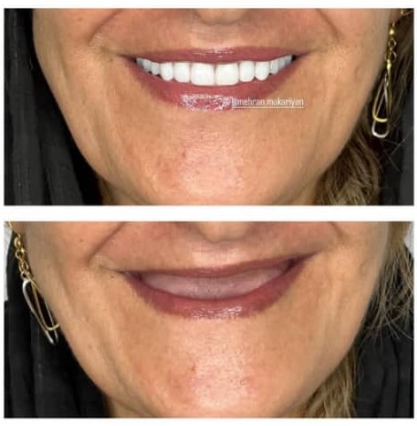 دندانسازی مکاریان در بوشهر دندانسازی مکاریان در بوشهر