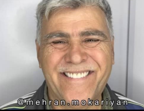 دندانسازی مکاریان در بوشهر دندانسازی مکاریان در بوشهر