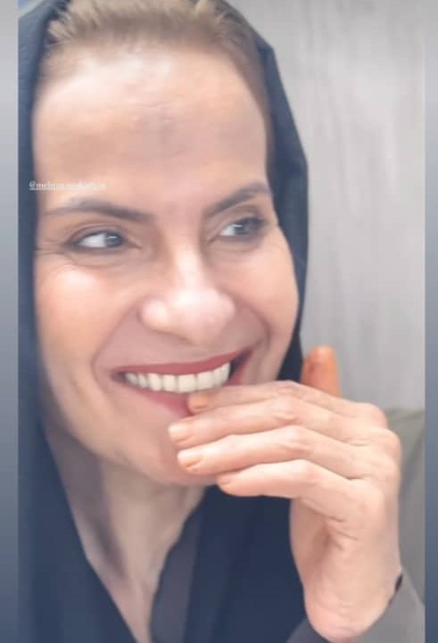 دندانسازی مکاریان در بوشهر دندانسازی مکاریان در بوشهر