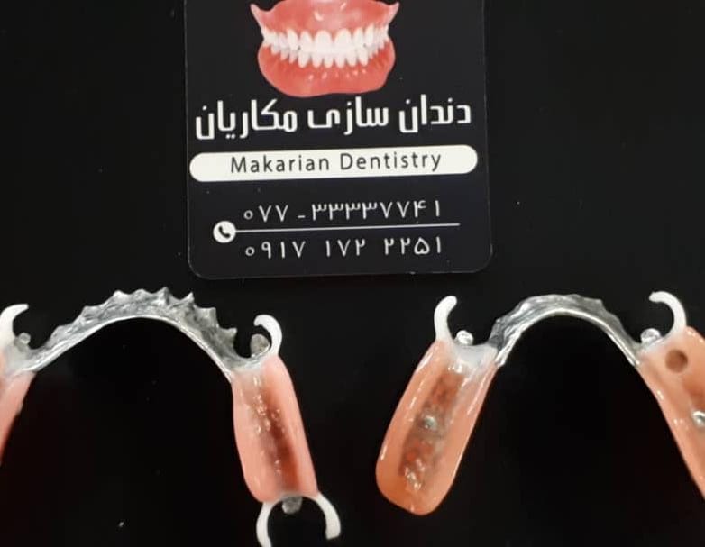 دندانسازی مکاریان در بوشهر دندانسازی مکاریان در بوشهر