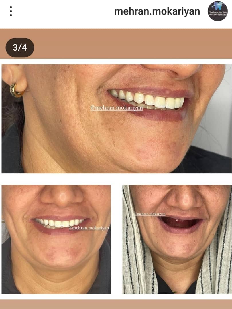 دندانسازی مکاریان در بوشهر دندانسازی مکاریان در بوشهر