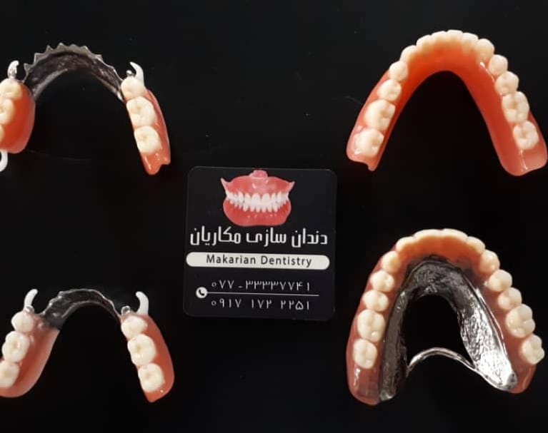 دندانسازی مکاریان در بوشهر دندانسازی مکاریان در بوشهر