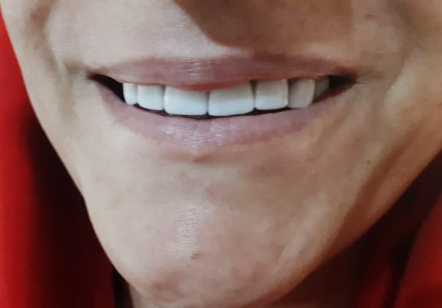 دندانسازی مکاریان در بوشهر دندانسازی مکاریان در بوشهر