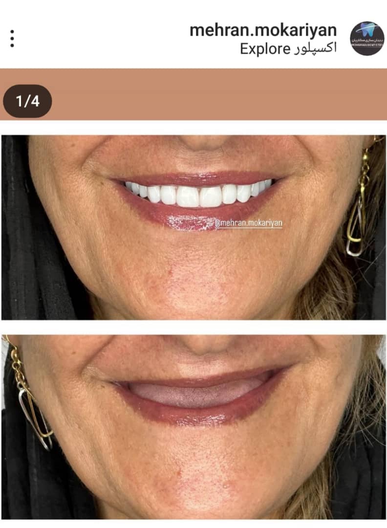 دندانسازی مکاریان در بوشهر دندانسازی مکاریان در بوشهر