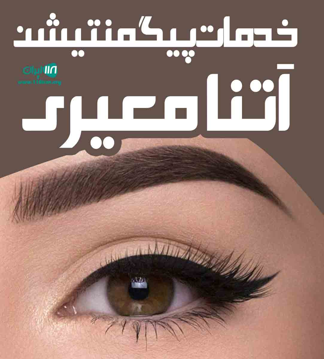 خدمات پیگمنتیشن آتنا معیری در مشهد خدمات پیگمنتیشن آتنا معیری در مشهد