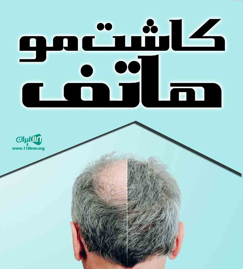 کاشت مو هاتف در تبریز