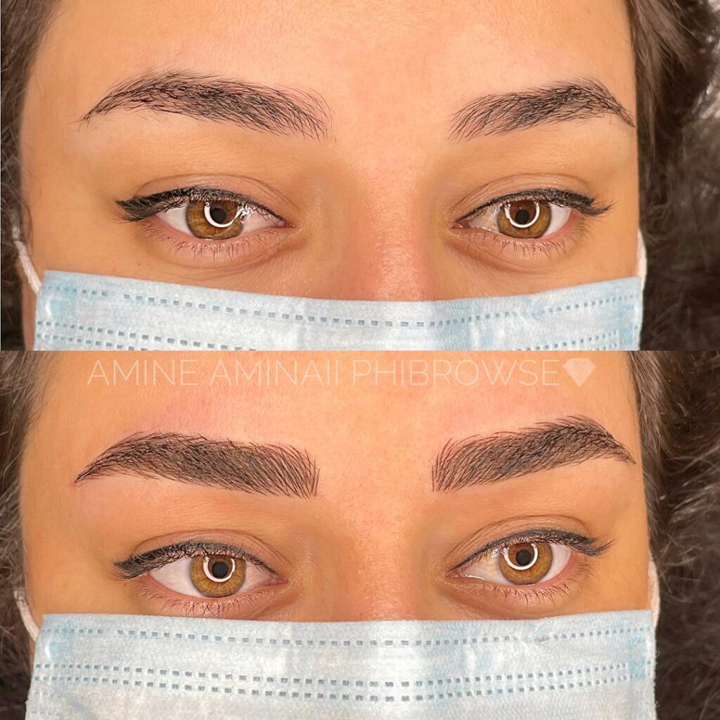 خدمات میکرو امینه امینایی در رفسنجان