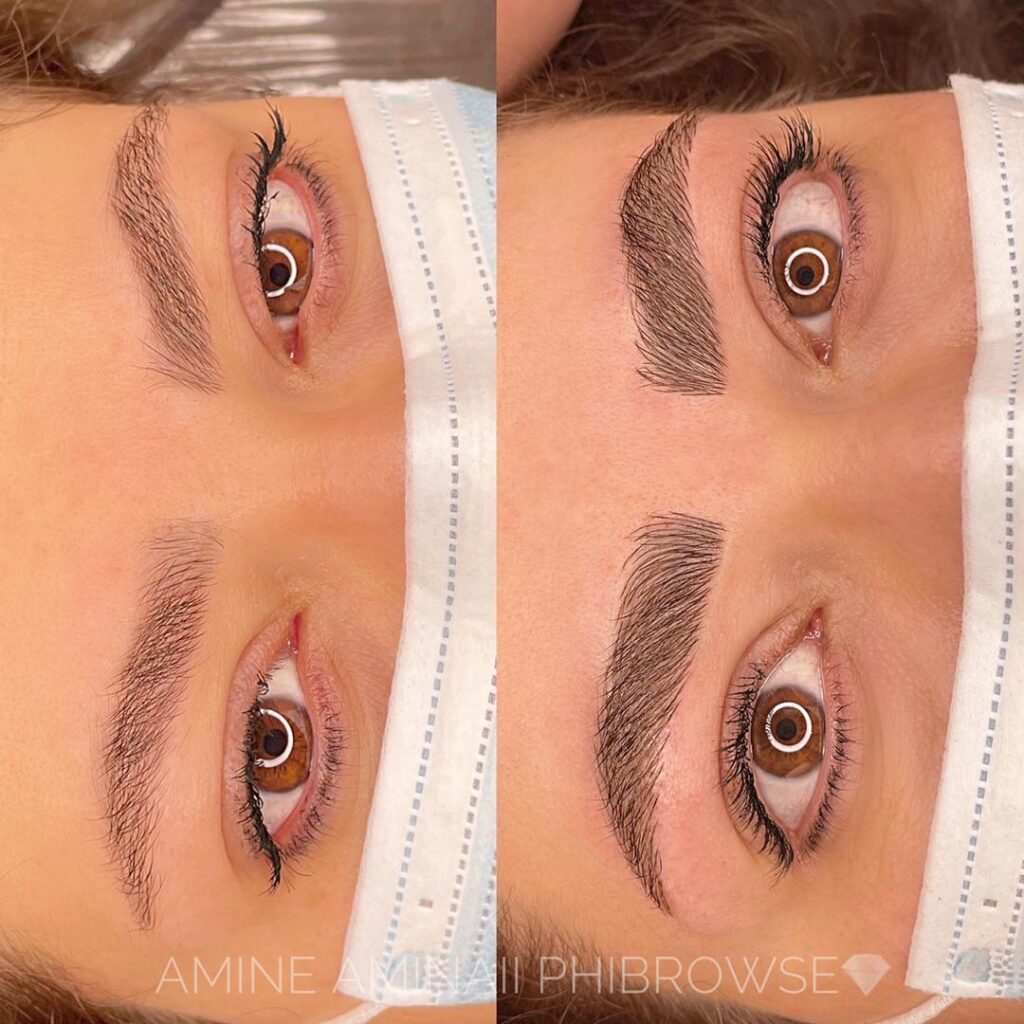 خدمات میکرو امینه امینایی در رفسنجان