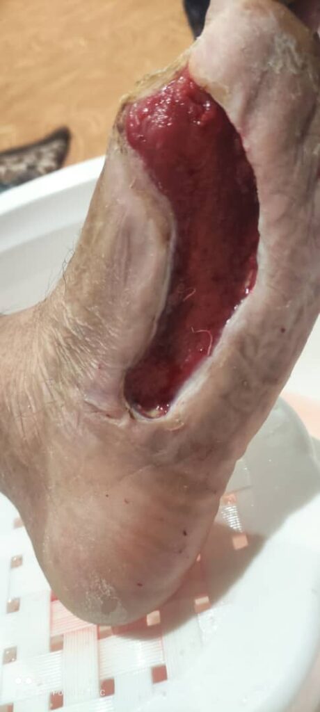 مرکز خدمات پرستاری منزل ساریژ در سردشت