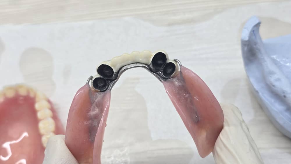 دندانسازی مکاریان در بوشهر دندانسازی مکاریان در بوشهر