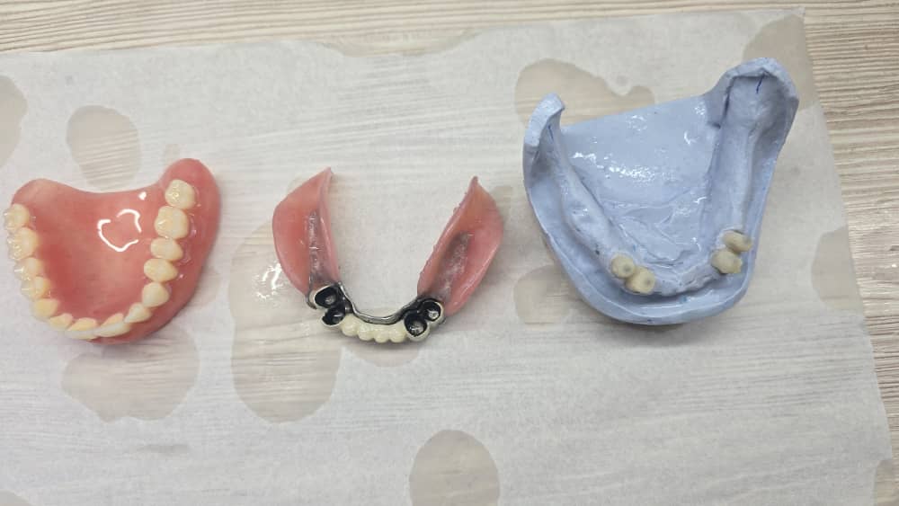 دندانسازی مکاریان در بوشهر دندانسازی مکاریان در بوشهر