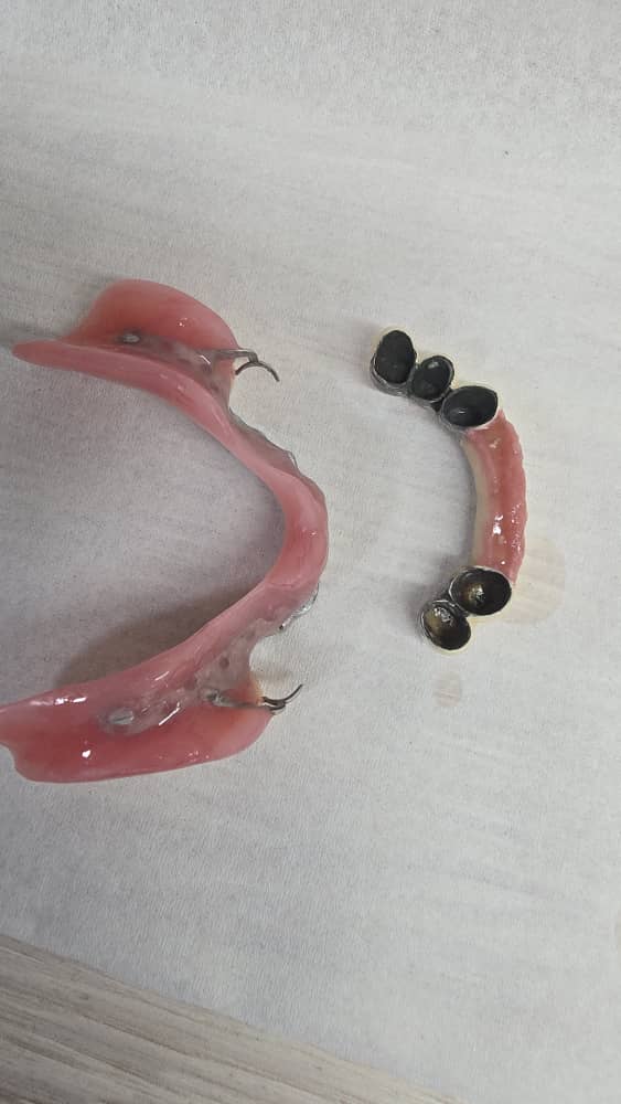 دندانسازی مکاریان در بوشهر دندانسازی مکاریان در بوشهر