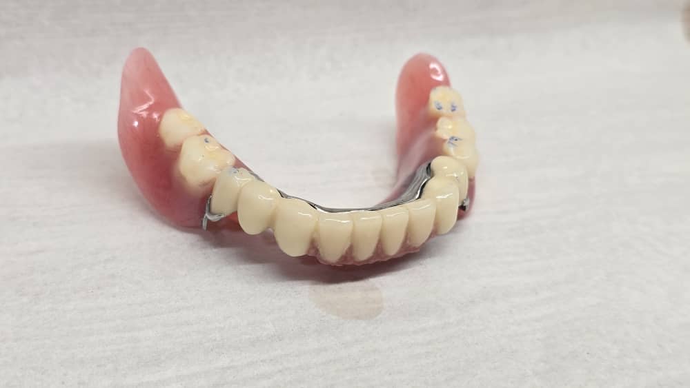 دندانسازی مکاریان در بوشهر دندانسازی مکاریان در بوشهر