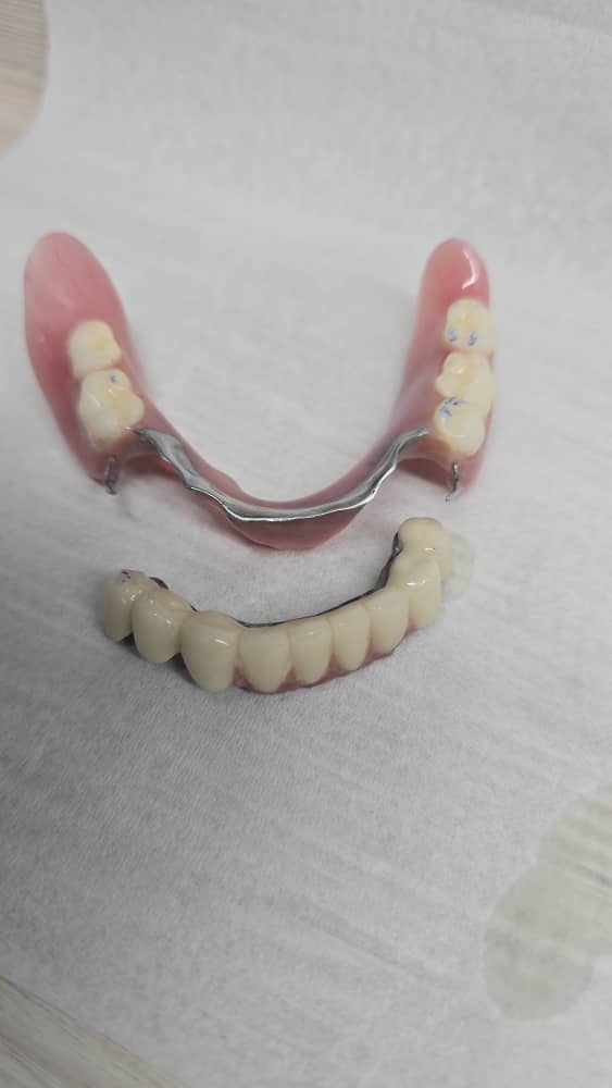 دندانسازی مکاریان در بوشهر دندانسازی مکاریان در بوشهر