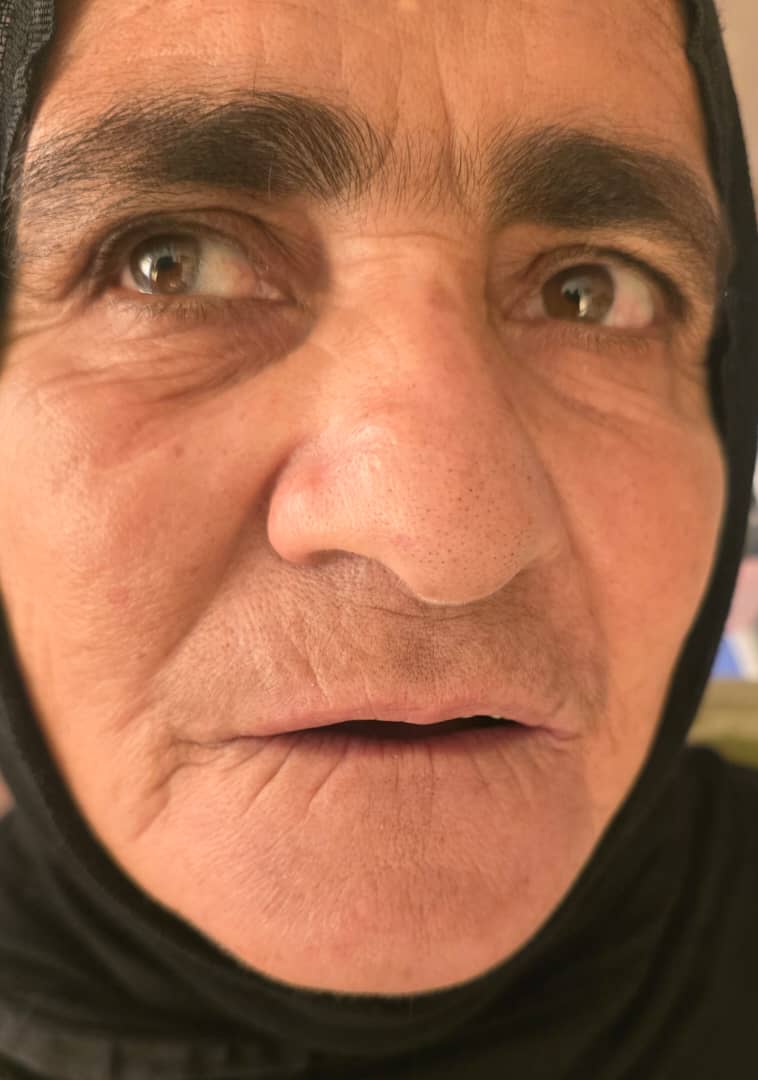 دندانسازی مکاریان در بوشهر دندانسازی مکاریان در بوشهر