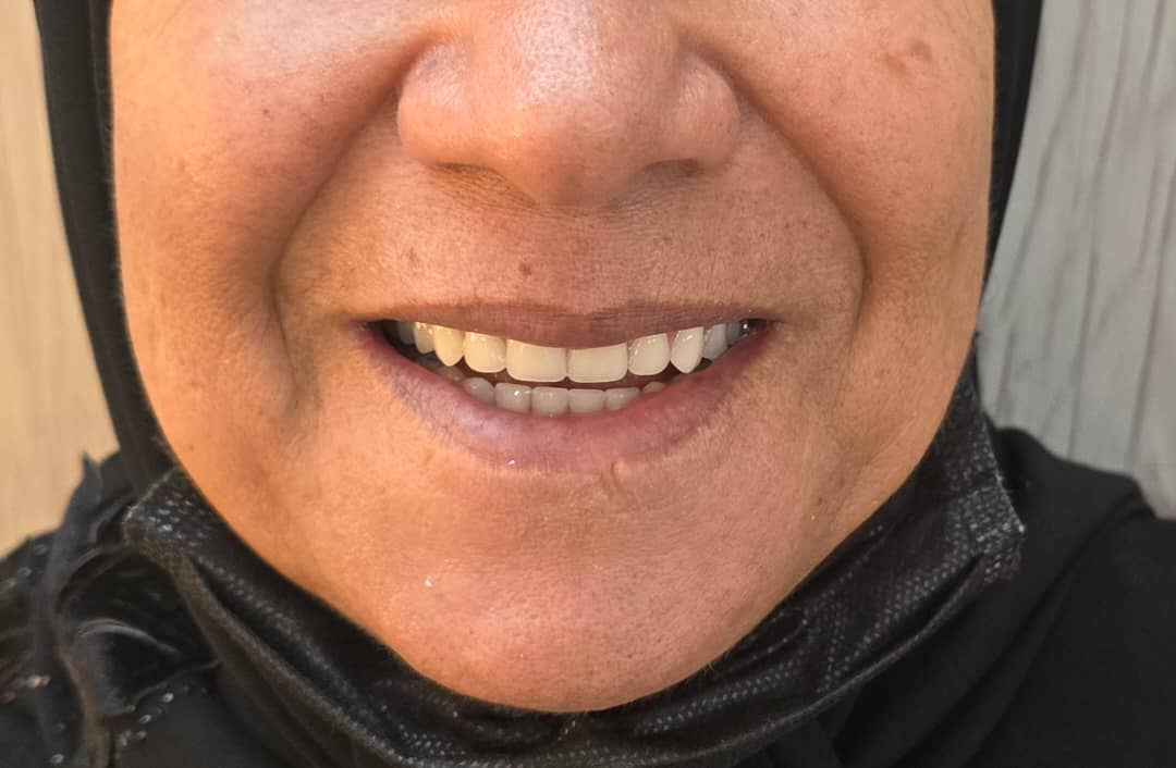 دندانسازی مکاریان در بوشهر دندانسازی مکاریان در بوشهر