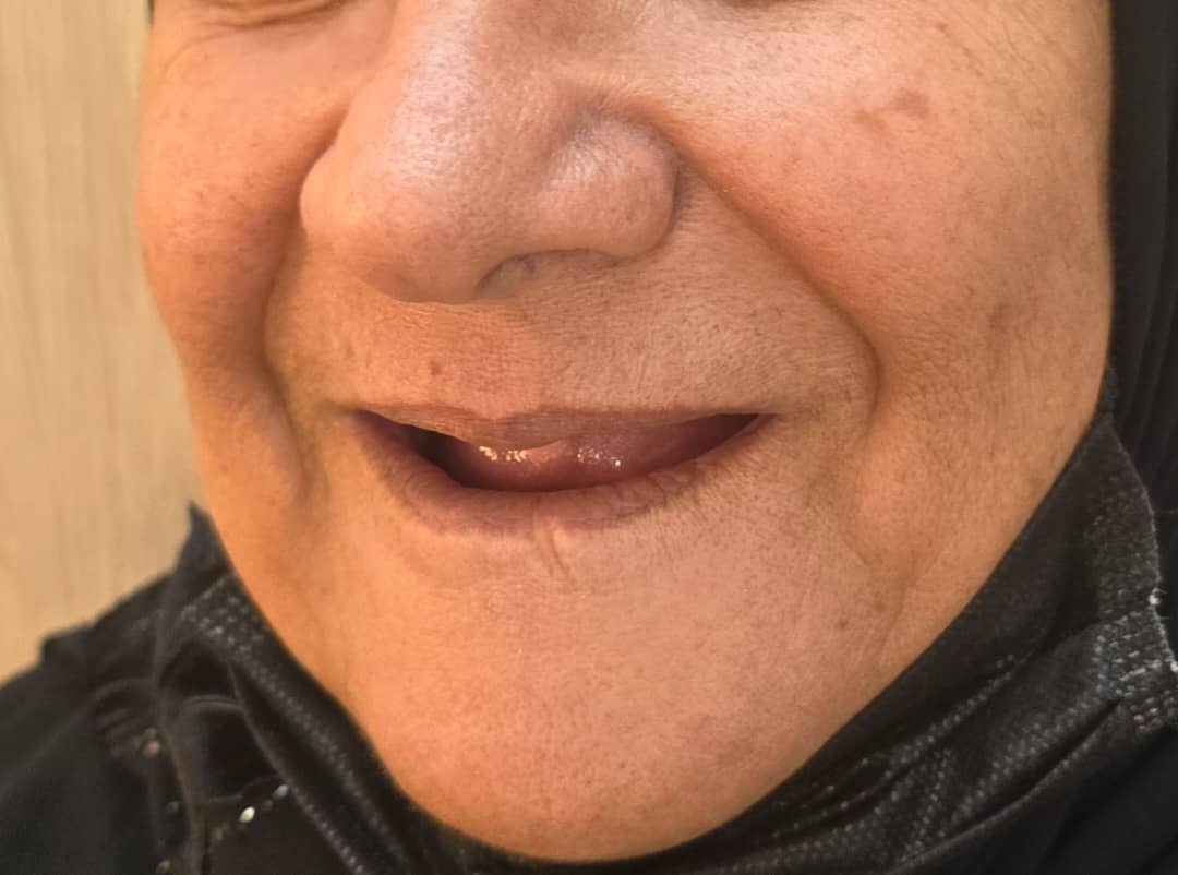 دندانسازی مکاریان در بوشهر دندانسازی مکاریان در بوشهر