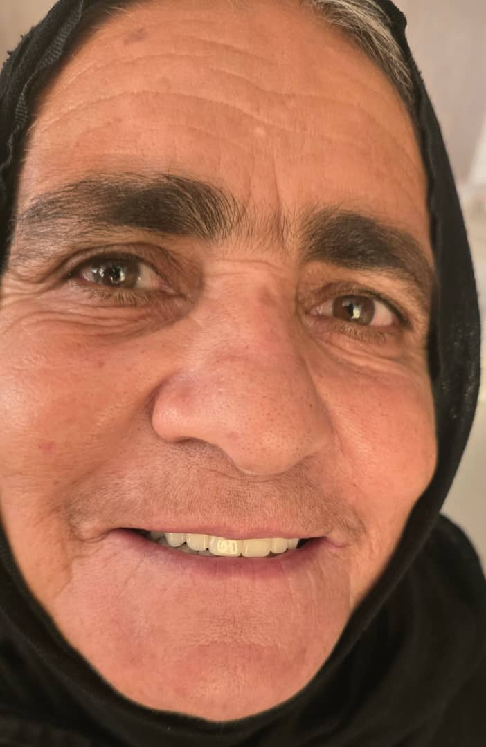 دندانسازی مکاریان در بوشهر دندانسازی مکاریان در بوشهر