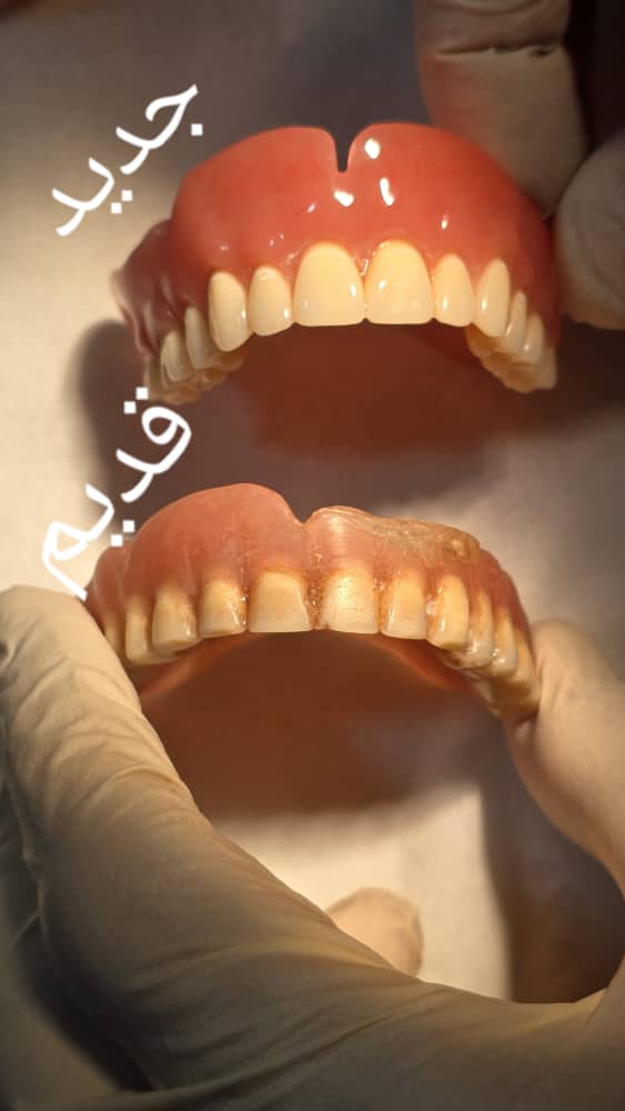 دندانسازی مکاریان در بوشهر دندانسازی مکاریان در بوشهر