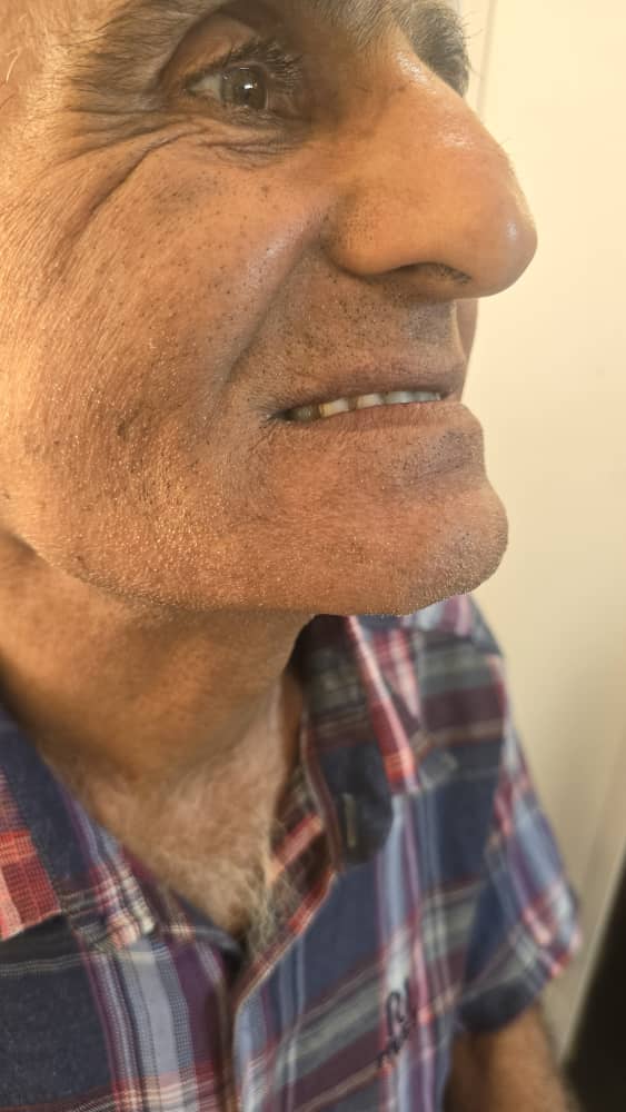 دندانسازی مکاریان در بوشهر دندانسازی مکاریان در بوشهر