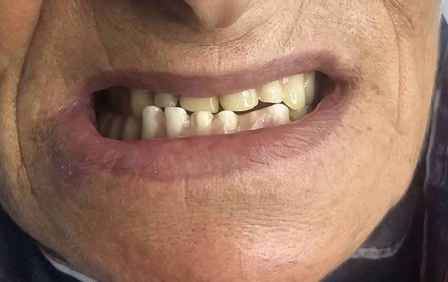 دندانسازی مکاریان در بوشهر